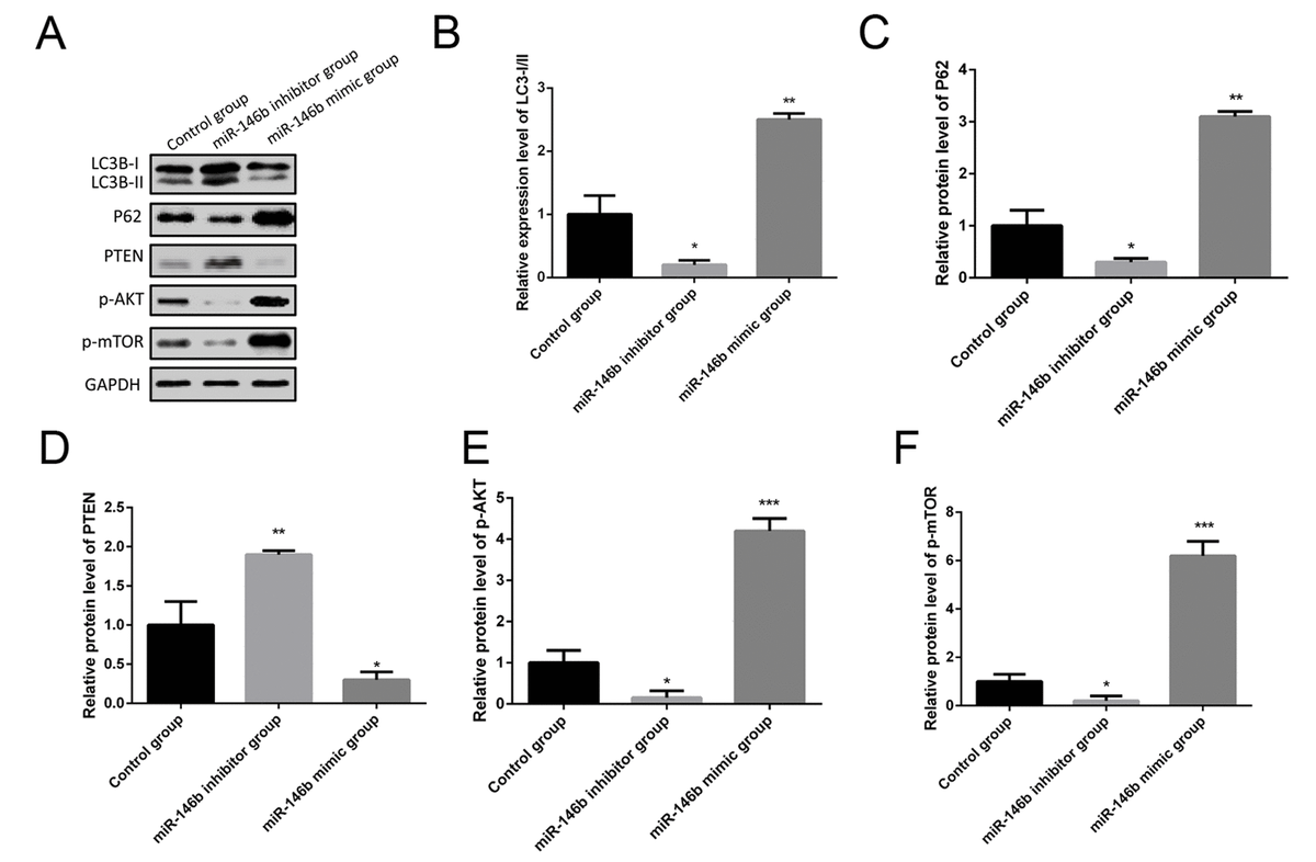 Mir B Inhibits Autophagy In Prostate Cancer By Targeting The Pten