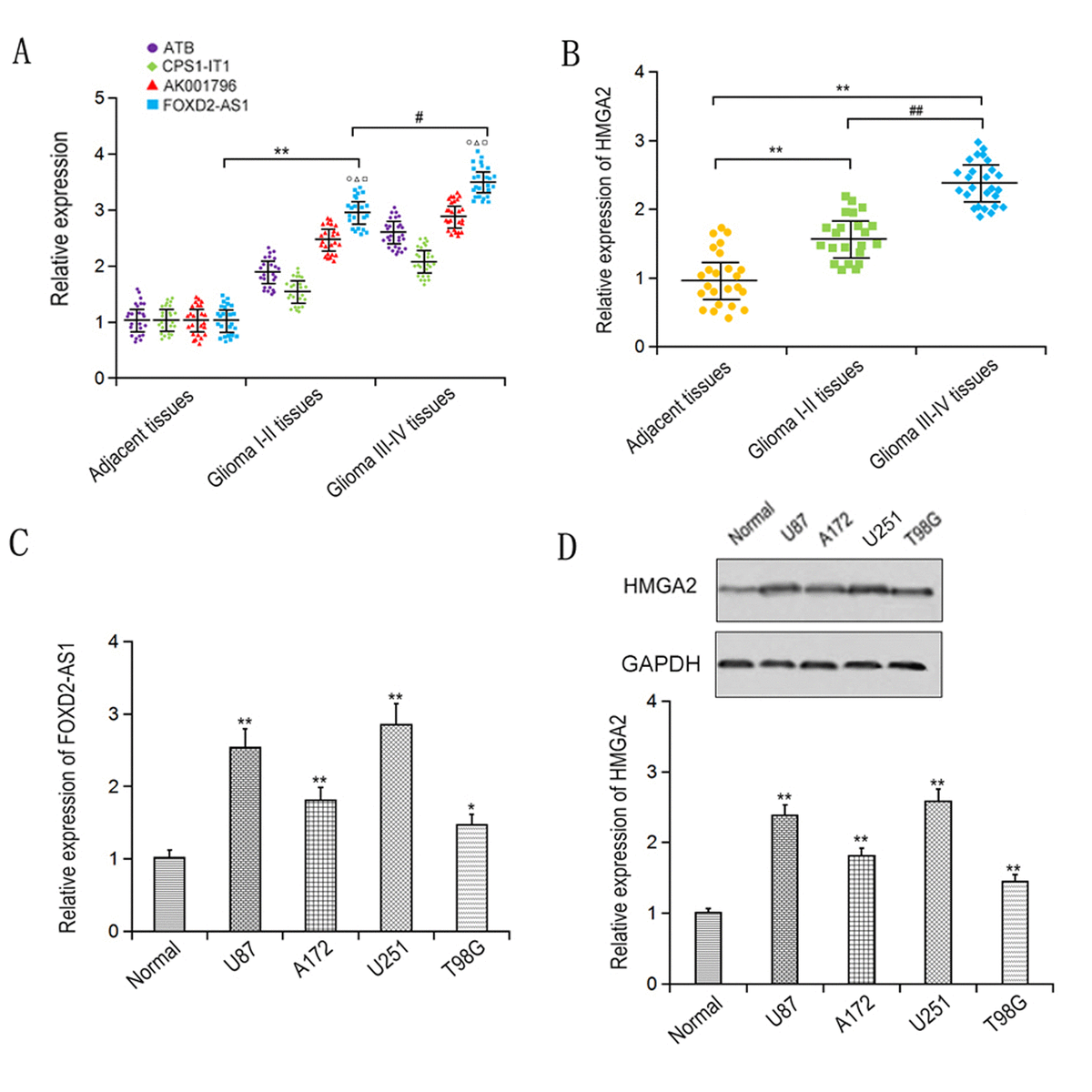 Foxd As Promotes Glioma Progression By Regulating Mir P Hmga