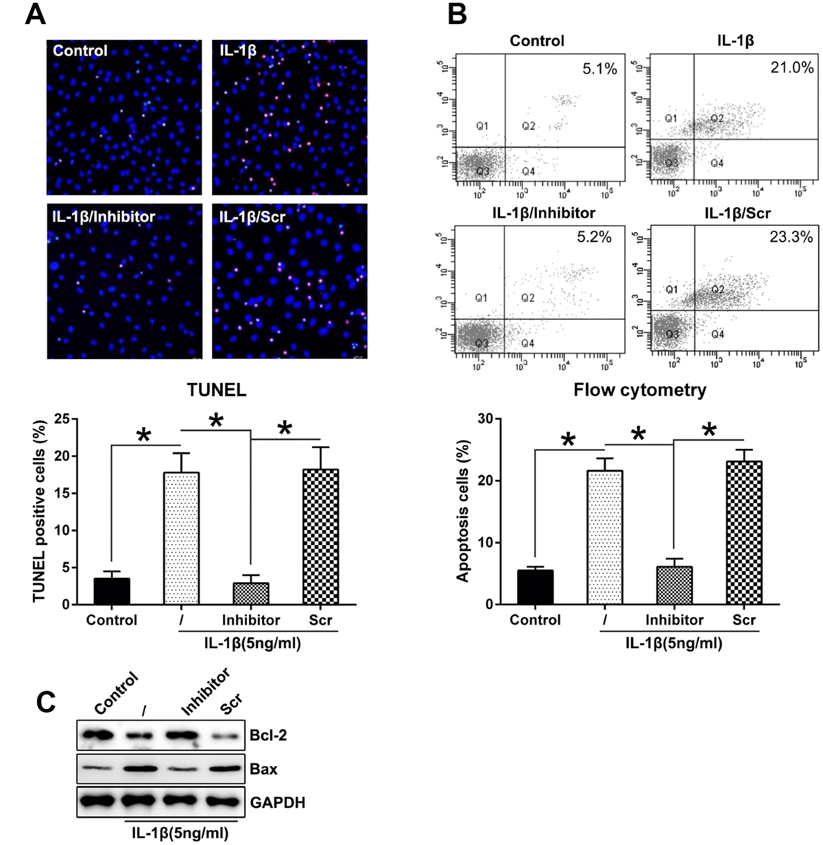 MiR 27a promotes the autophagy and apoptosis of IL 1β treated articular