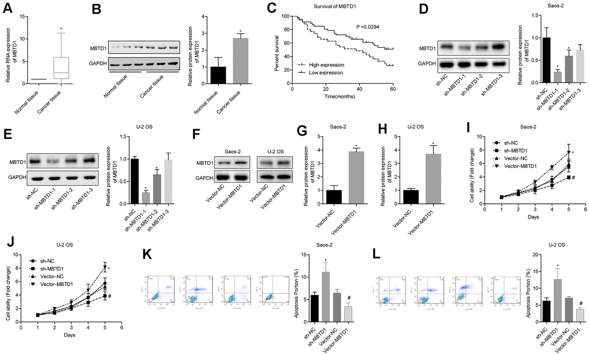 Lncrna Ttn As Regulates Osteosarcoma Cell Apoptosis And Drug