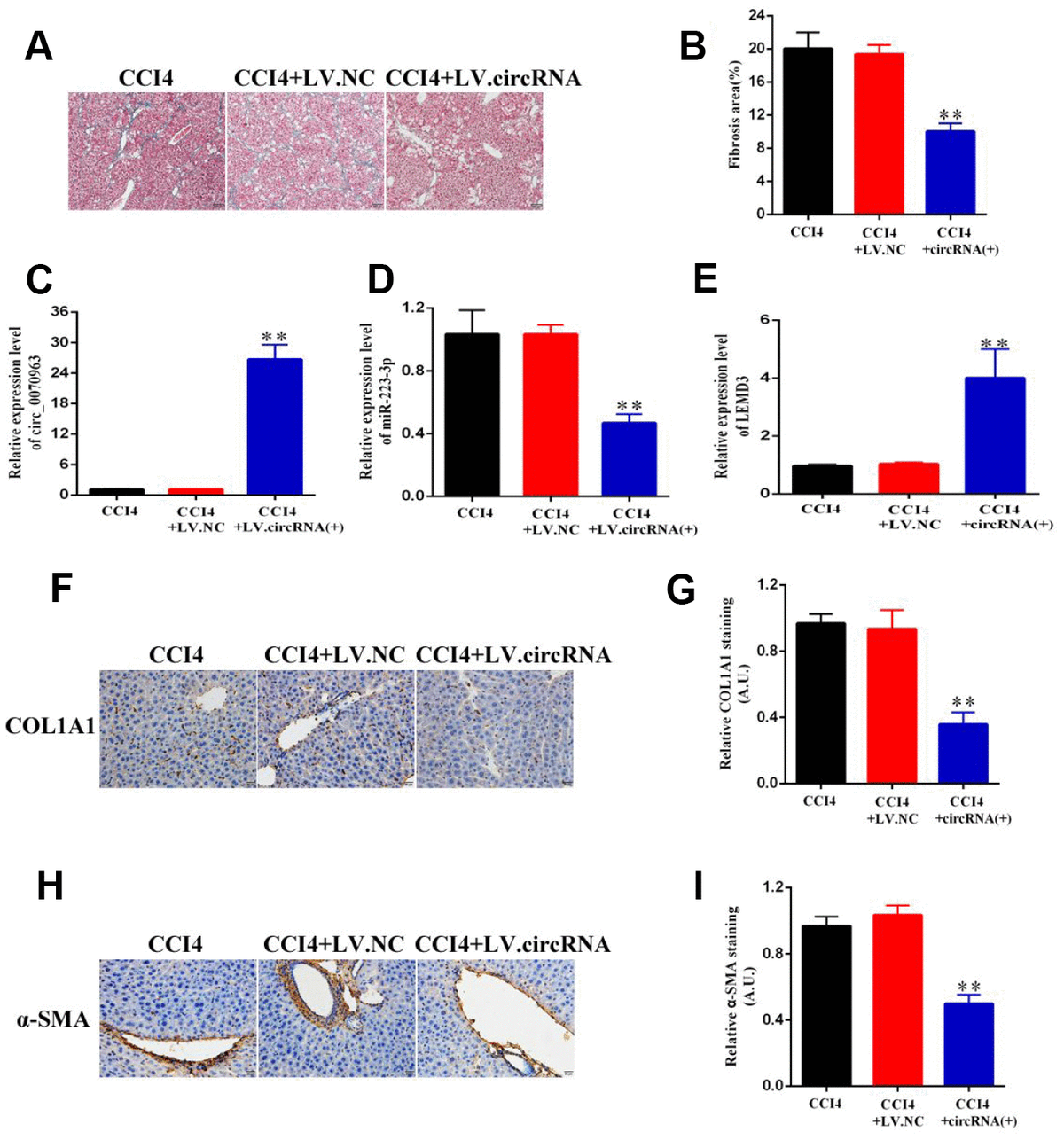 Hsa Circ 0070963 Inhibits Liver Fibrosis Via Regulation Of MiR 223 3p