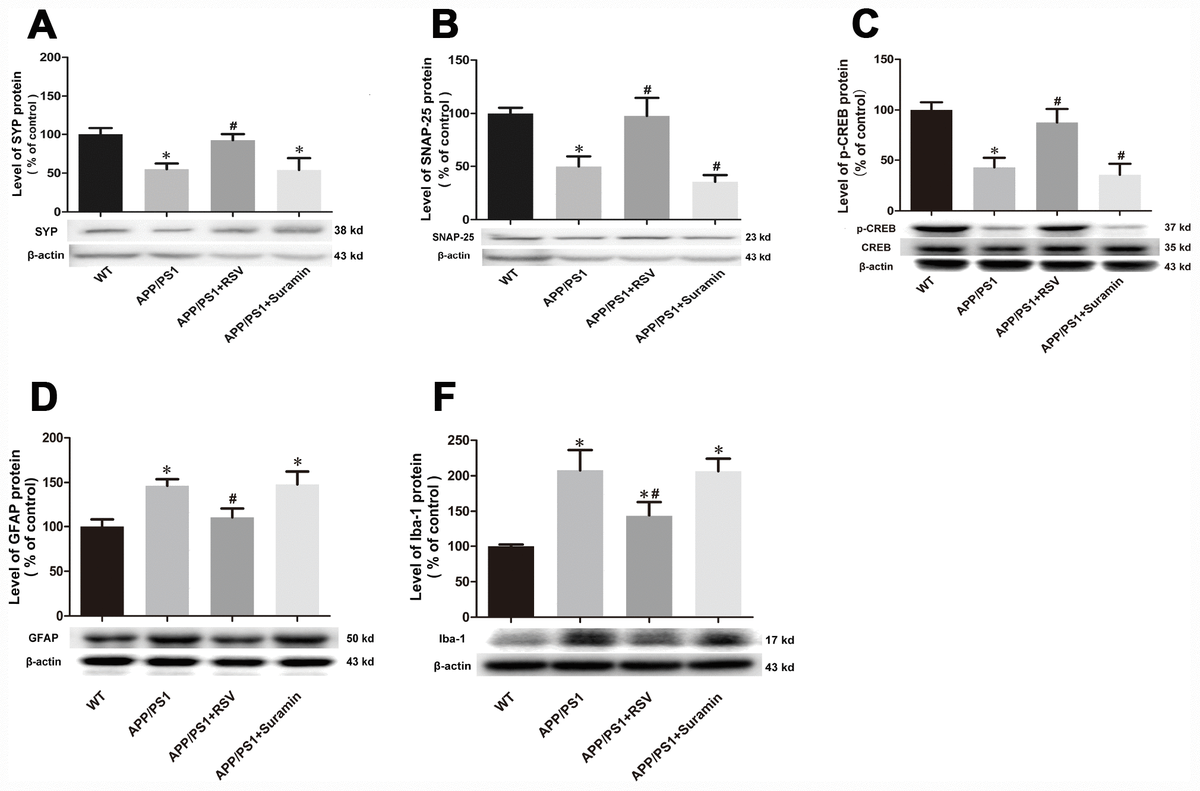 The Neuroprotective Effects Of SIRT1 In Mice Carrying The APP PS1