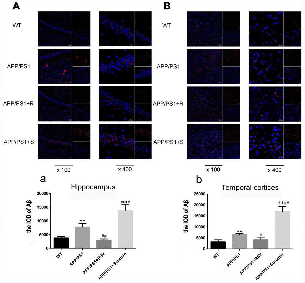 The Neuroprotective Effects Of SIRT1 In Mice Carrying The APP PS1