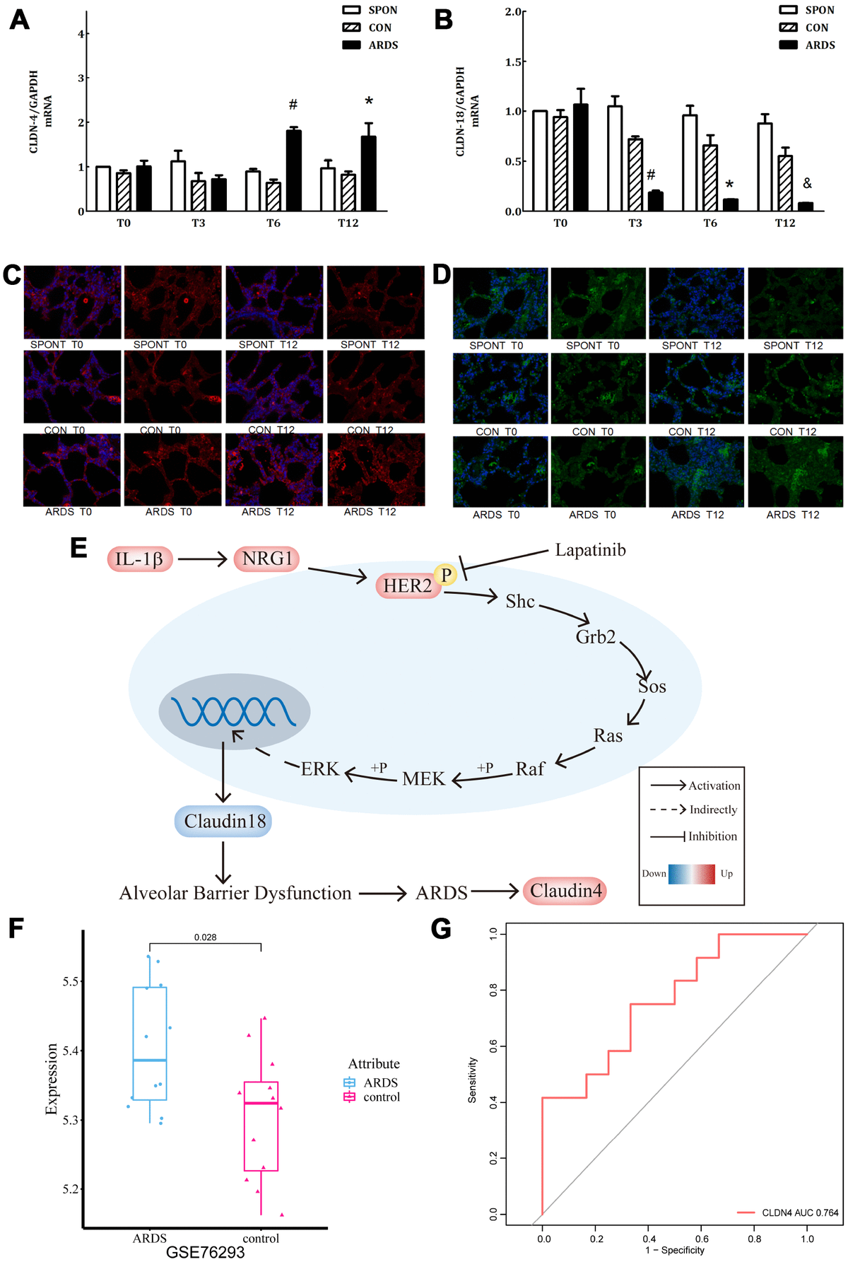 The IL1β HER2 CLDN18 CLDN4 axis mediates lung barrier damage in ARDS