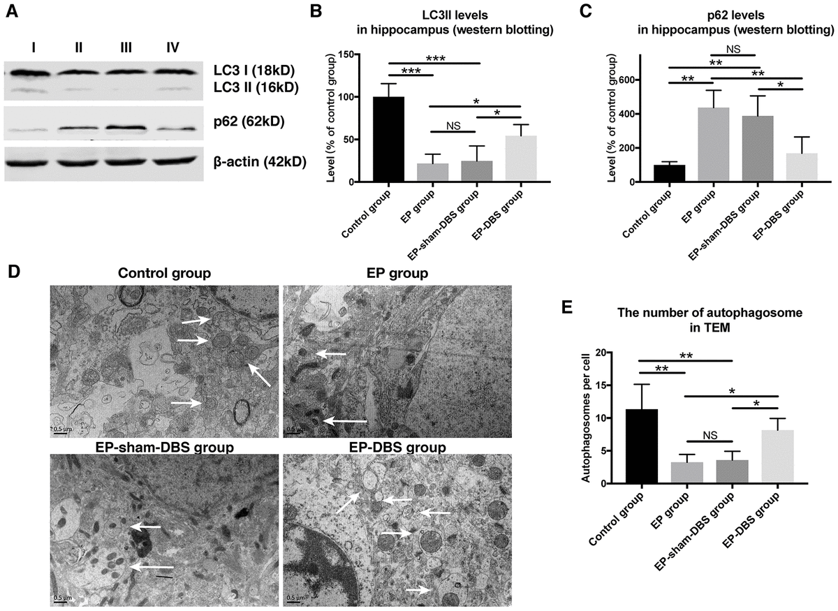 Anterior Thalamic Nucleus Stimulation Protects Hippocampal Neurons By