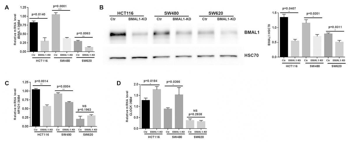 BMAL1 Knockdown Triggers Different Colon Carcinoma Cell Fates By