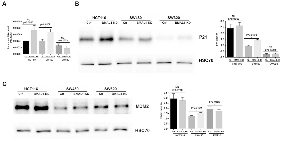 Bmal Knockdown Triggers Different Colon Carcinoma Cell Fates By