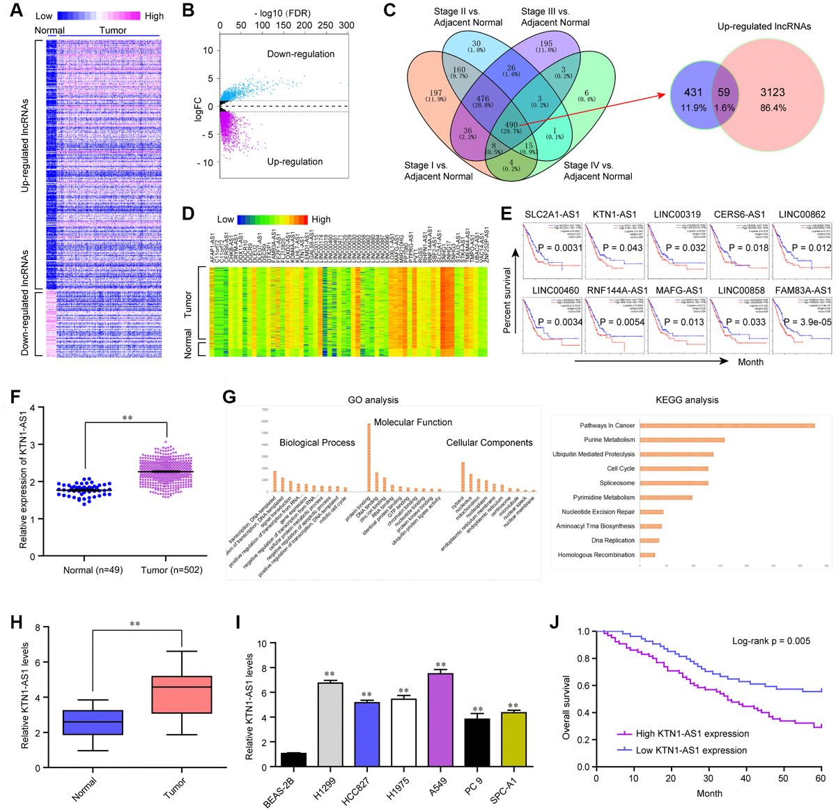 STAT1 Induced Upregulation Of LncRNA KTN1 AS1 Predicts Poor Prognosis