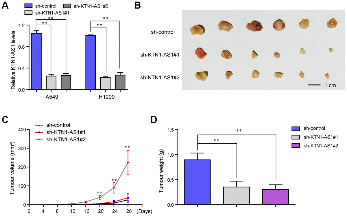 Stat Induced Upregulation Of Lncrna Ktn As Predicts Poor Prognosis