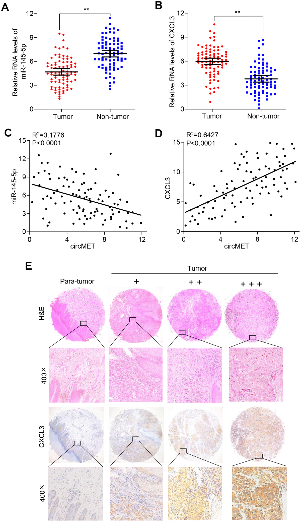 Circmet Promotes Nsclc Cell Proliferation Metastasis And Immune