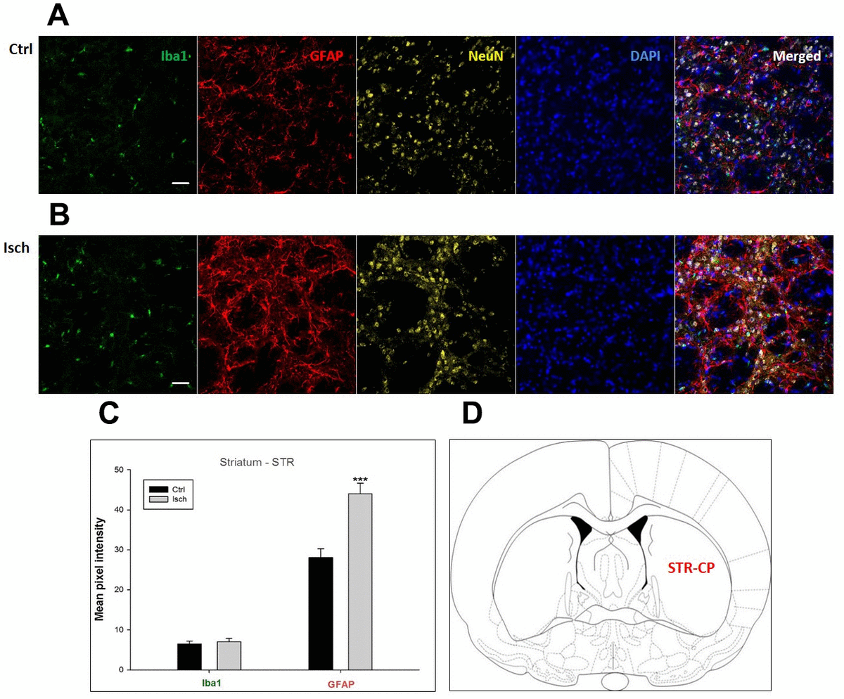 Heterogeneity In Brain Distribution Of Activated Microglia And