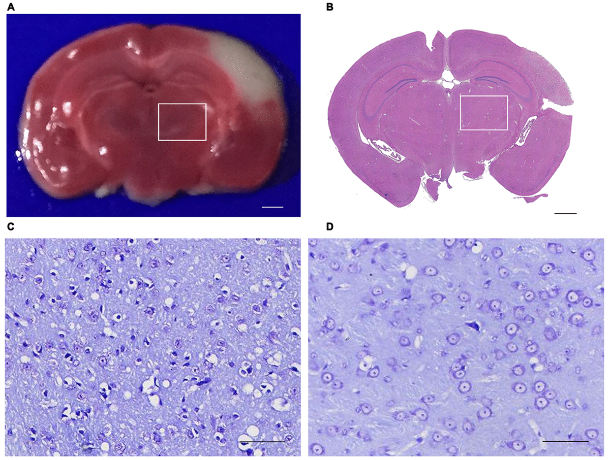 Altered Circular Rna Expression Profiles In The Non Ischemic Thalamus