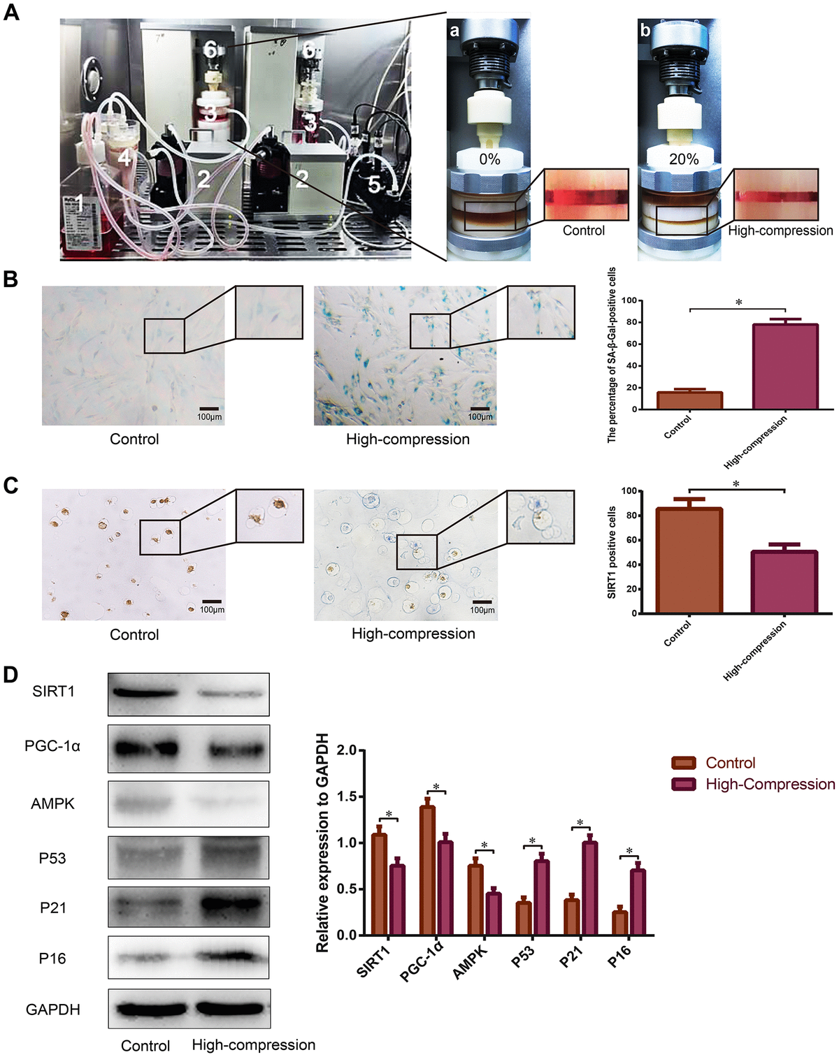 Sirt Alleviates High Magnitude Compression Induced Senescence In