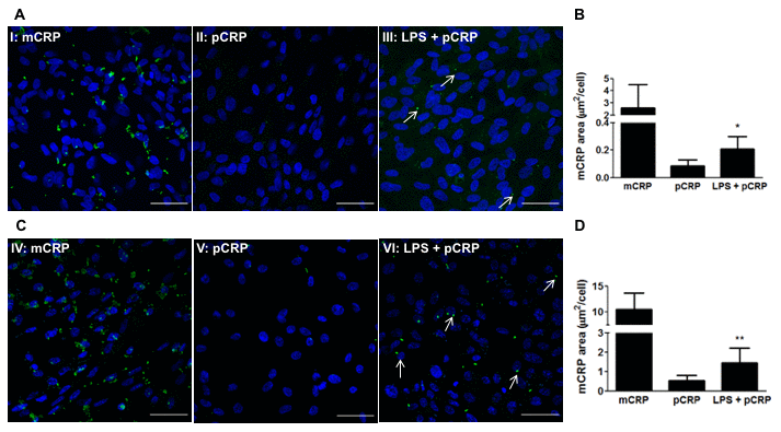 LPS-induced inflammation promotes CRP dissociation in RPE cells. RPE cells were treated with 100 μg/mL LPS for 24h before adding pCRP. After 24h, RPE cells were treated with pCRP for 48h and the presence of mCRP on the surface of RPE cells was measured by immunofluorescence. mCRP immunostaining of ARPE-19 (A) and primary porcine RPE (B) cells treated with 10 μg/ml mCRP for 48h (I, IV), 25 μg/ml pCRP for 48h (II, V), or 100 μg/ml LPS 24h before treatment with 25 μg/ml pCRP for 48h (III, VI). Arrows point mCRP dissociated from pCRP on RPE surface. Nuclei stained with DAPI. Scale bar = 50 μm. Images shown are representative of three independent experiments. (C, D) Quantification of CRP dissociation measured as stained area with the monoclonal antibody 3H12 against mCRP (green) divided by the number of cells per image (μm2/cell). Results are expressed as mean area (μm2/cell) ± SD (N=3). Statistical analysis was performed by student t-test. *P