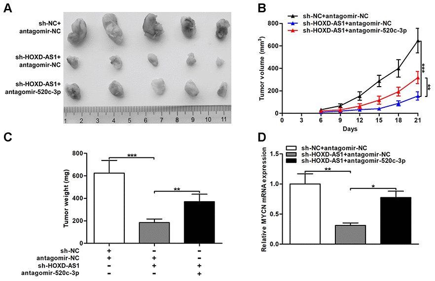 Sp Induced Hoxd As Promotes Malignant Progression Of