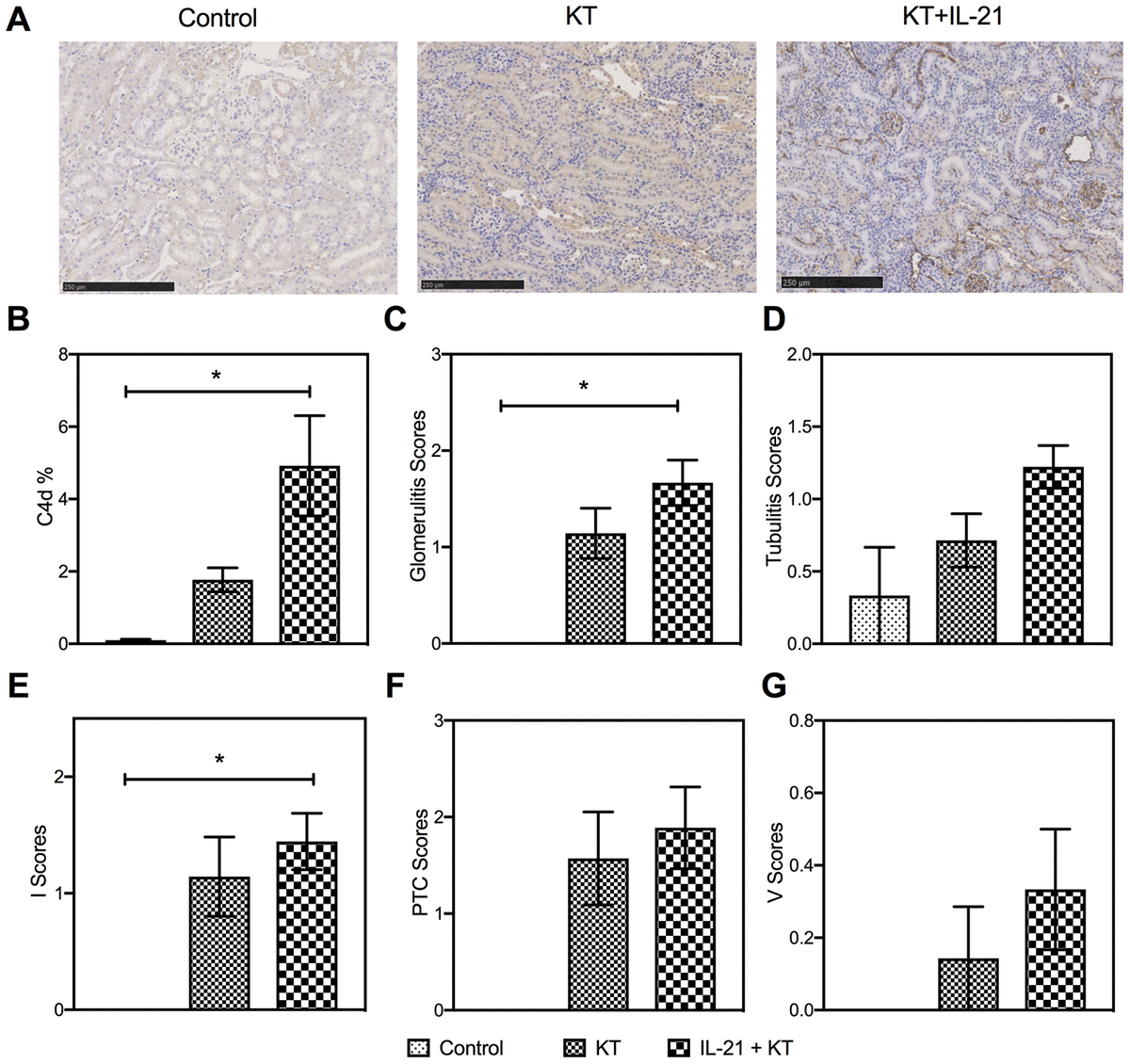 Elevated Serum IL 21 Levels Are Associated With Stable Immune Status In