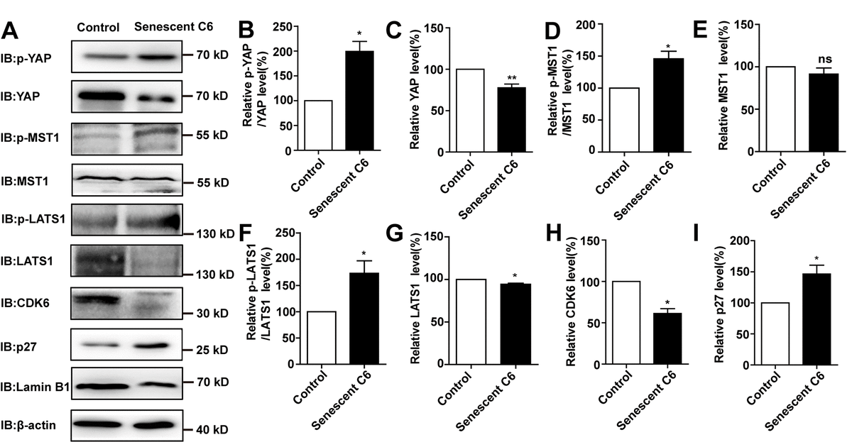 D Galactose Induces Senescence Of Glioblastoma Cells Through Yap Cdk