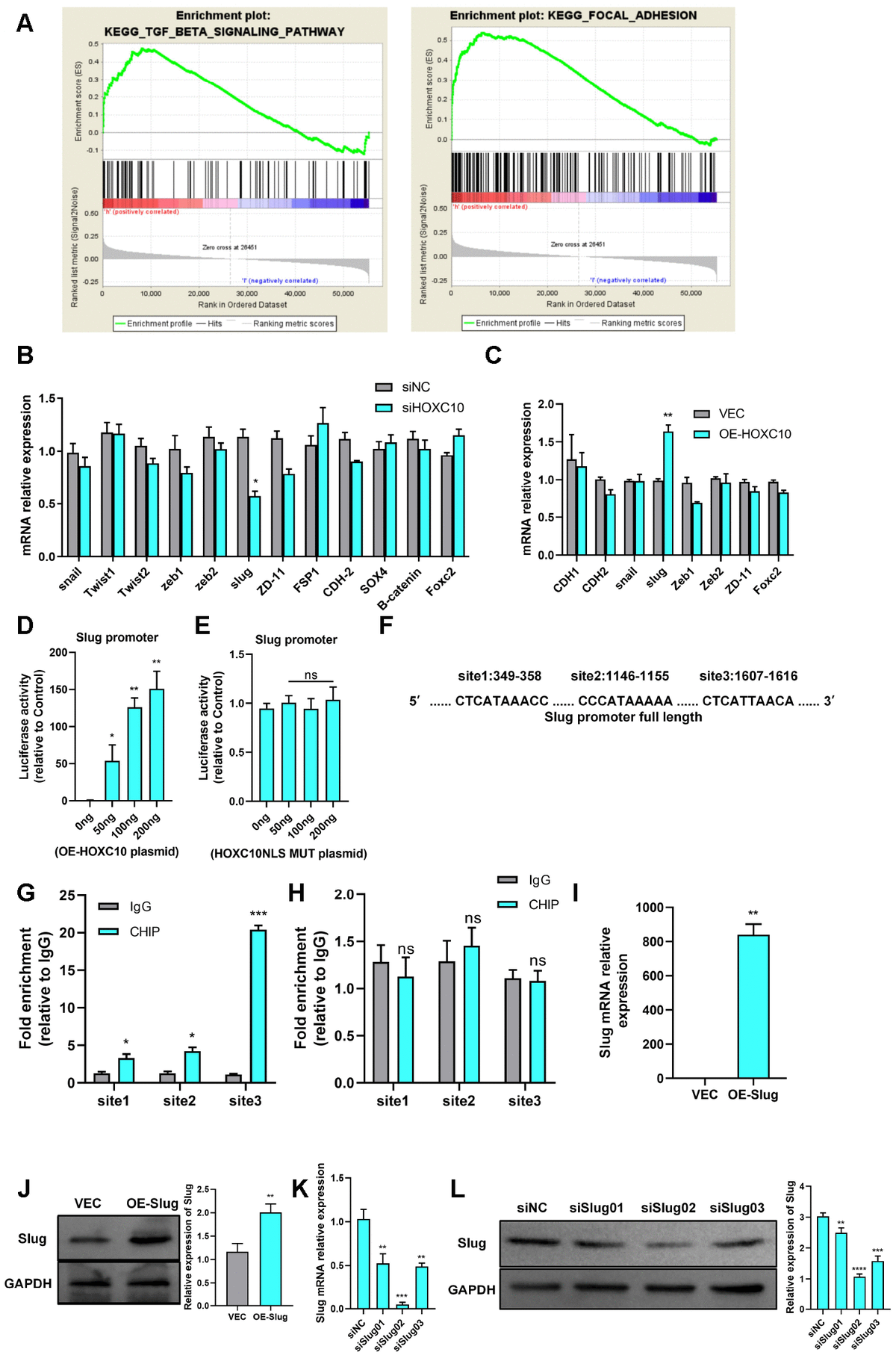 HOXC10 Promotes Tumour Metastasis By Regulating The EMT Related Gene