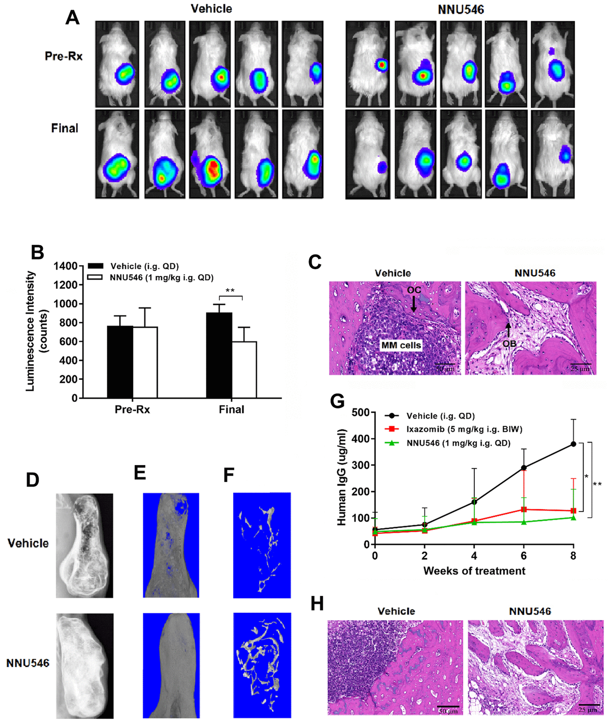 In Vitro And In Vivo Efficacy Of The Novel Oral Proteasome Inhibitor