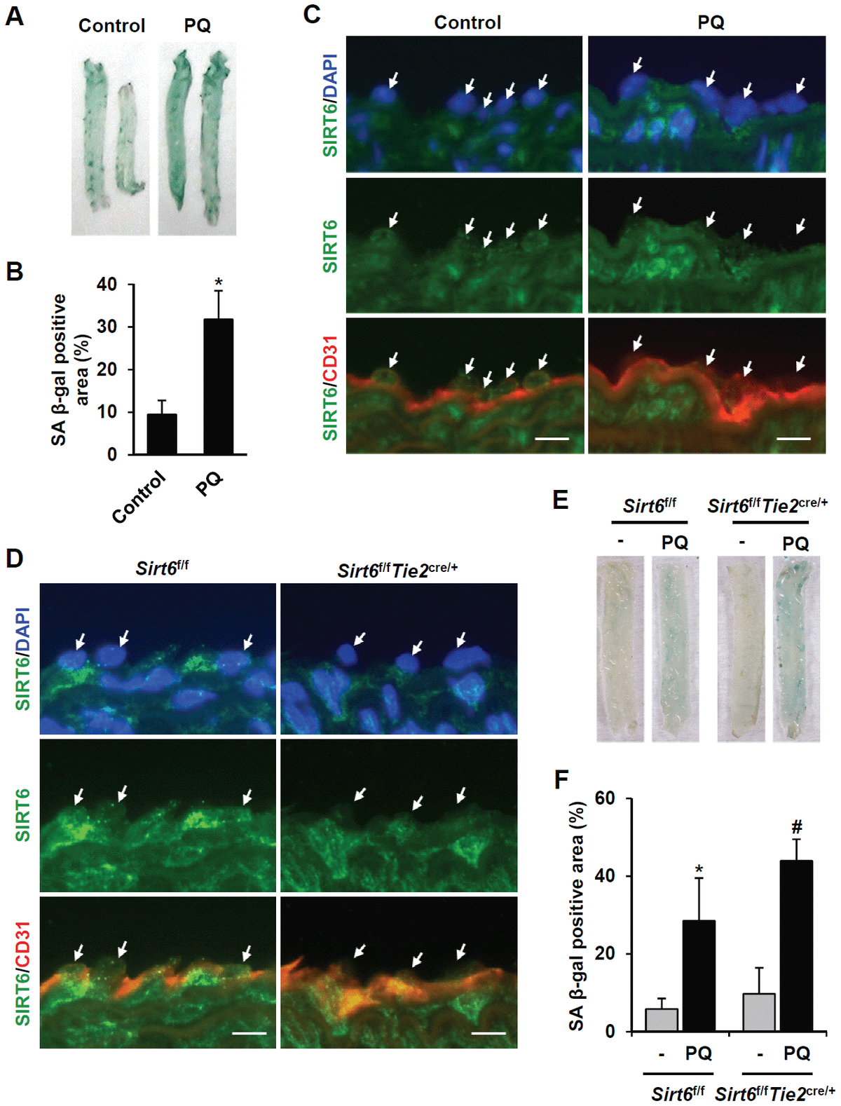 Sirtuin Deficiency Induces Endothelial Cell Senescence Via