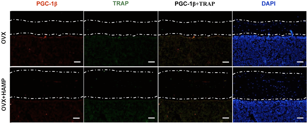 Hepcidin Induced Reduction In Iron Content And Pgc Expression