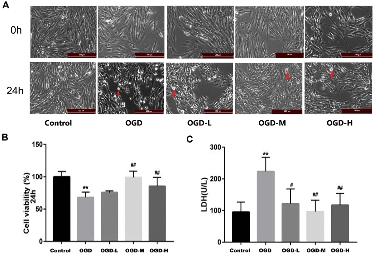 Alisol A 24 Acetate Protects Against Brain Microvascular Endothelial