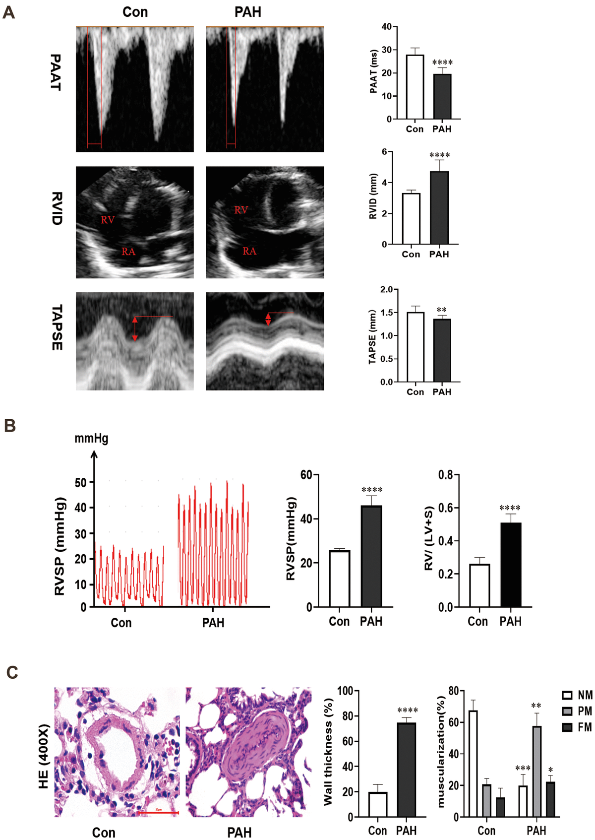 Integrated Analysis Of M6A MRNA Methylation In Rats With Monocrotaline