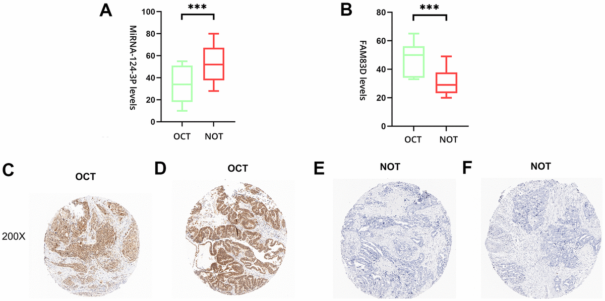 Mirna P Functions As A Potential Tumor Suppressor Directly