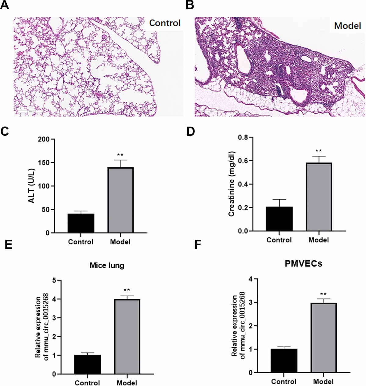 The Circular Rna Hsa Circ Regulates Sepsis Induced Lung Injury