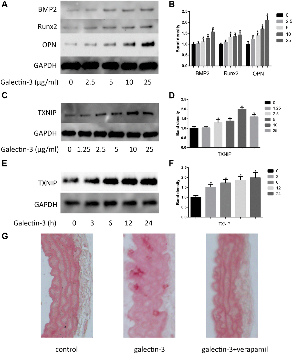 Galectin Induces Vascular Smooth Muscle Cells Calcification Via Ampk