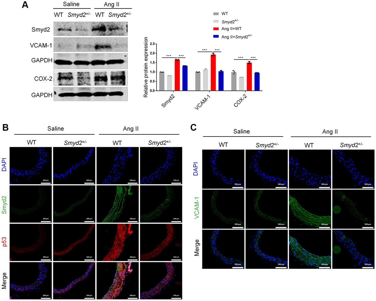 Histone Methyltransferase Smyd Drives Vascular Aging By Its Enhancer