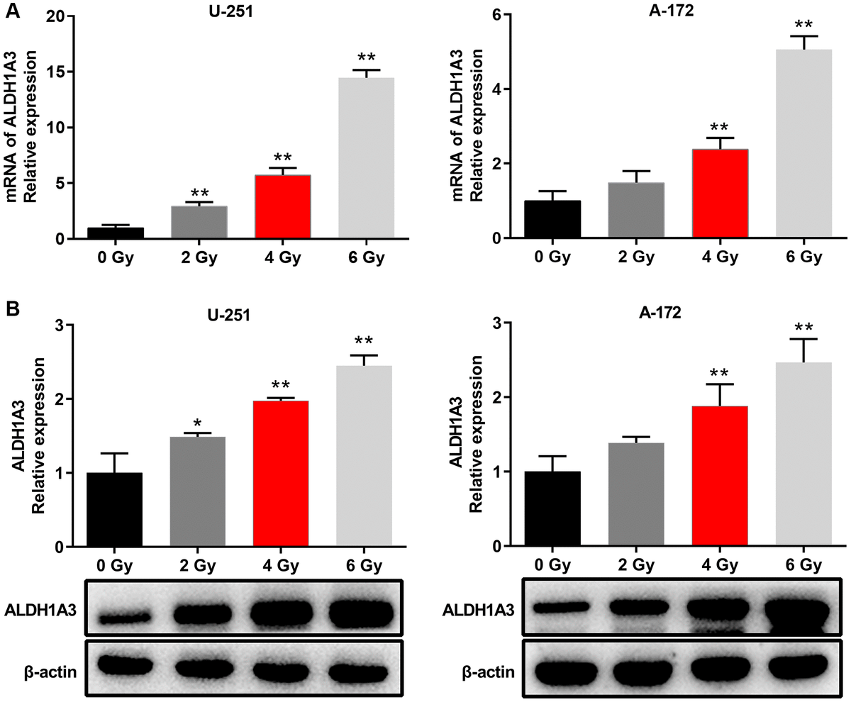 MiR 320b Aberrant Expression Enhances The Radioresistance Of Human