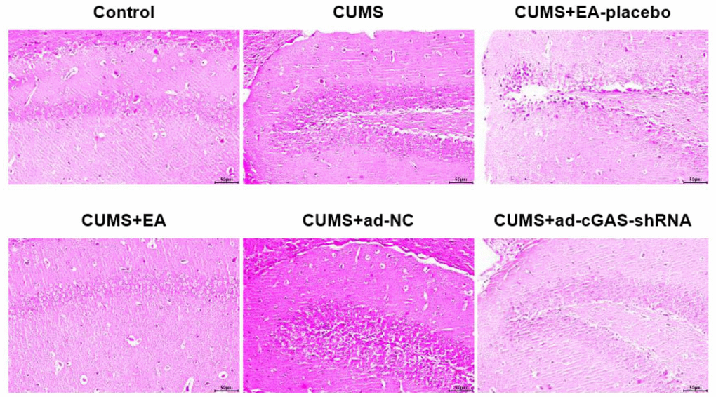 The impact of EA and knockdown of cGAS on the pathological state in the hippocampus was evaluated by HE staining assay.
