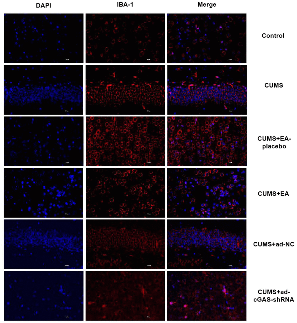 EA and knockdown of cGAS significantly inhibited the activation of microglia in depressed mice. The expression of IBA-1 in the hippocampus was measured using the immunofluorescence assay.