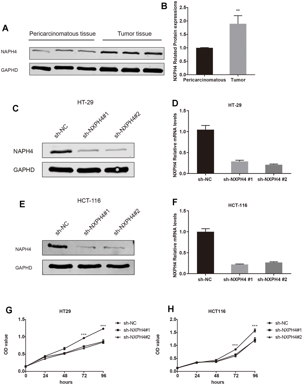 The expression of NXPH4 in colon cancer tissues was verified and knocked down in cell lines. (A, B) Western blot was used to verify the expression of NXPH4 at the protein level in colon cancer and para-cancer tissues. (C) NXPH4 was knocked down in HT-29 cell line and verified by Western blot. (D) NXPH4 was knocked down in HT-29 cell line and verified by qPCR. (E) NXPH4 was knocked down in HCT-116 cell line and verified by Western blot. (F) NXPH4 was knocked down in HCT-116 cell line and verified by qPCR. (G) CCK8 assay of control HT-29 cell line and HT-29 cell line with NXPH4 knockdown. (H) CCK8 assay for control HCT-116 cell line and HCT-116 cell line with NXPH4 knockdown.