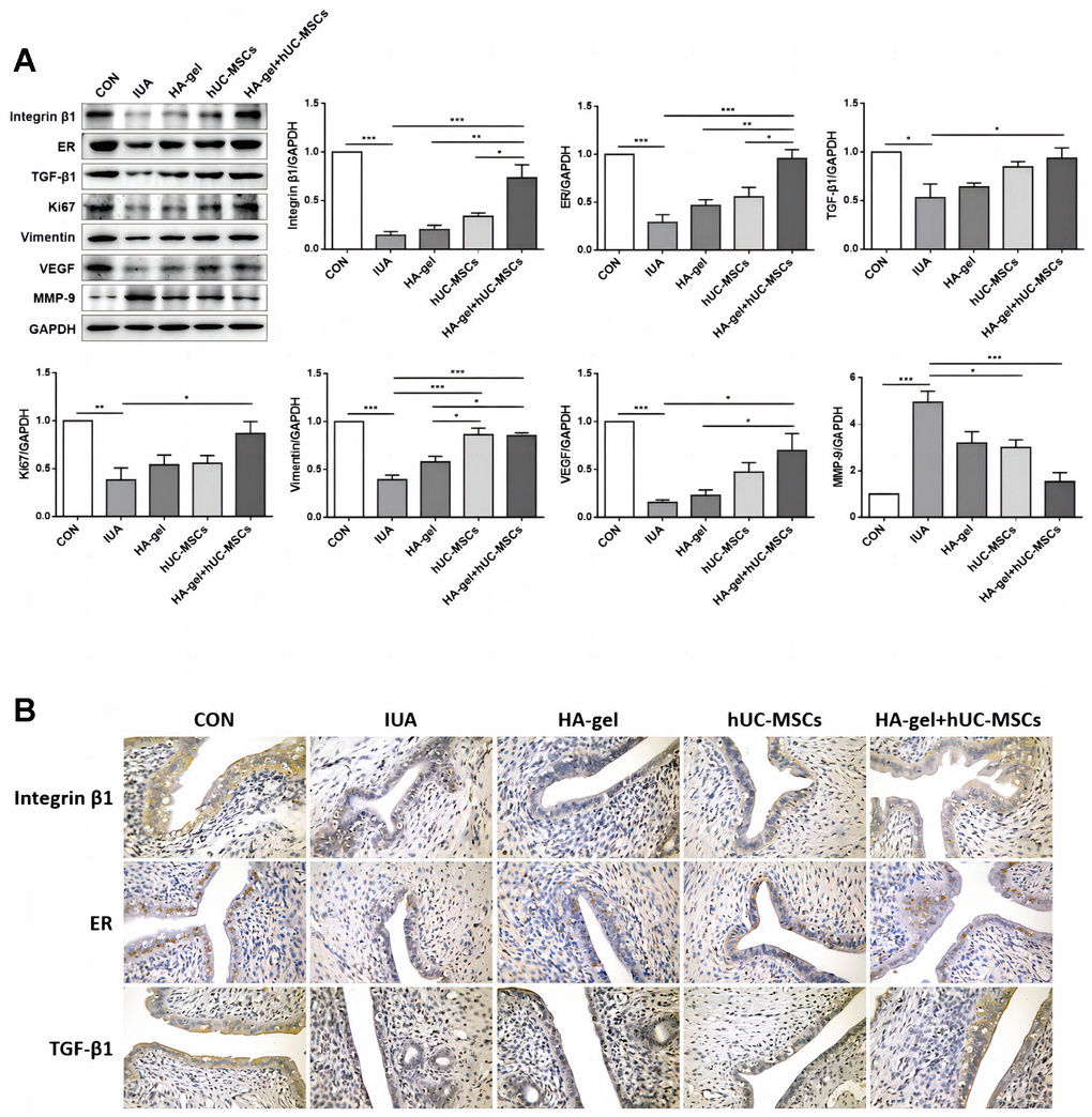 Effects of different treatments on endometrial proliferation, fibrosis, and estrogen regulation. (A) The expression levels of Integrin β1, ER, TGF-β1, Ki67, Vimentin, VEGF, and MMP-9 were determined by Western blot; (B) Integrin β1, ER, and TGF-β1 were confirmed by immunohistochemical analyses. RE, Estrogen Receptor; TGF, Transforming Growth Factor; VEGF, Vascular Endothelial Growth Factor; MMP, Matrix Metalloproteinase.