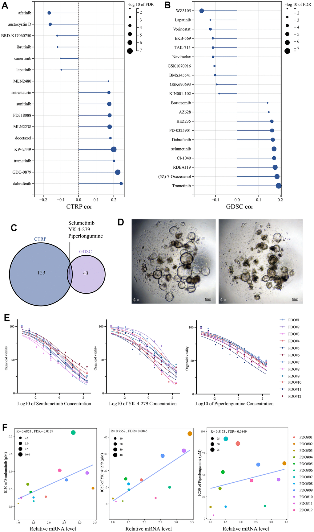 Drug sensitivity analysis based on SUSD4 expression. (A) CTRP database and (B) GDSC database. (C) Venn diagram between two drug datasets. (D) Colorectal cancer organoids under a 4X microscope, the length of the bar is 100μM. (E) IC50 for three drugs in 12 organoids. (F) Spearman correlation between mRNA level of SUSD4 and IC50 of three drugs, the size and color of the dots represent IC50 and organoids’ ID respectively. CTRP, cancer therapeutics response portal. GSDC, genomics of drug sensitivity in cancer. IC50, half maximal inhibitory concentration. P-values were adjusted by false discovery rate (FDR) method.