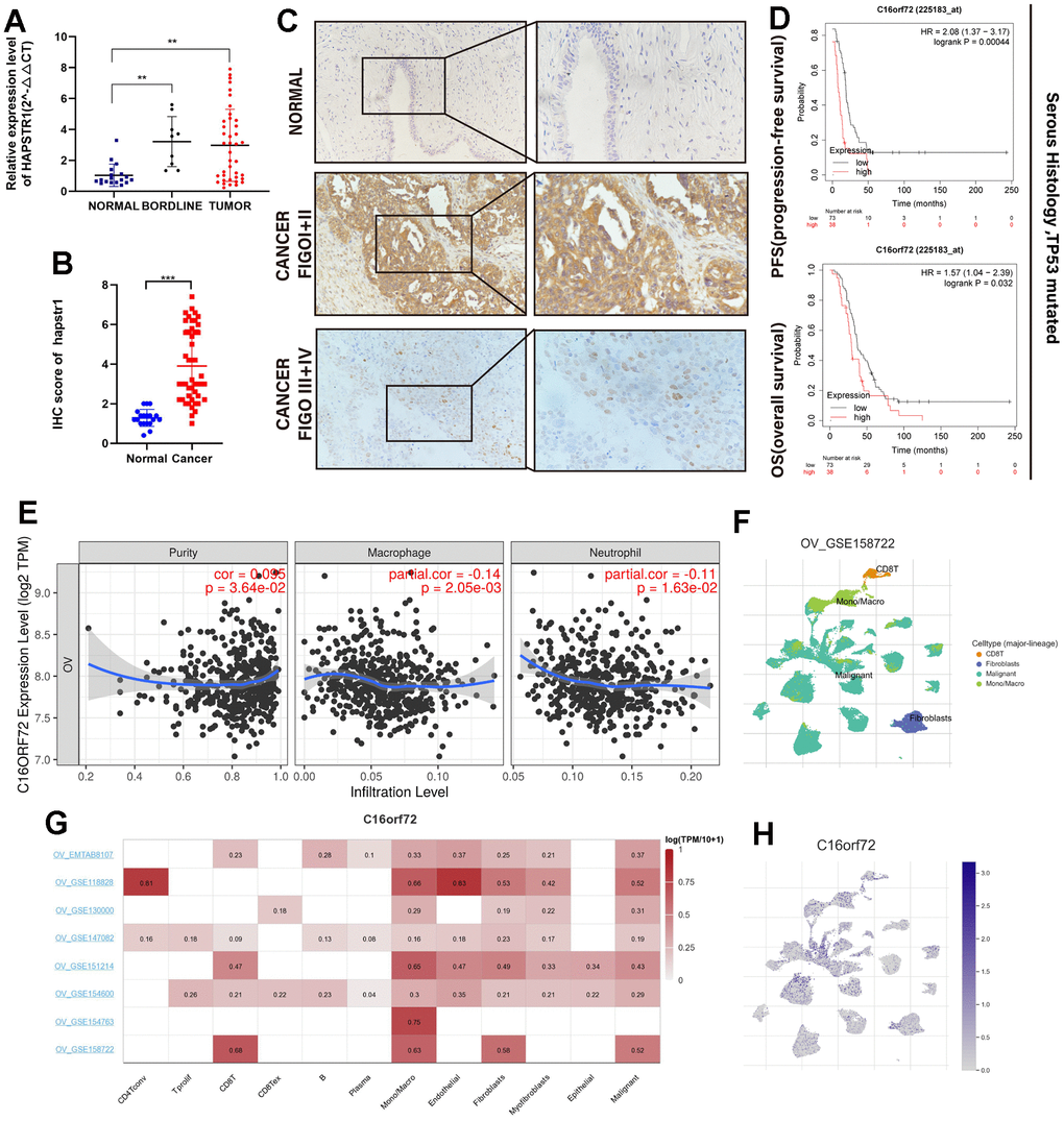 HAPSTR1 was overexpressed in ovarian cancer tissues and closely related to clinical outcome. (A) Clinical samples in Cohort 1 were used to detect mRNA expression levels of HAPSTR1, including 18 normal ovarian tissues, 9 borderline ovarian tumors, and 40 primary ovarian cancer specimens. (B) An immunohistochemistry assay was used to detect protein expression levels of HAPSTR1 in Cohort 2, including 47 epithelial ovarian cancer and 19 normal ovarian tissues. (C) IHC results of Cohort 2 showed HAPSTR1 expression was related to FIGO stage. Original magnification, 200X, 400X. (D) Kaplan–Meier survival analysis of overall and progression-free survival in patients with ovarian cancer. (E) The relationship between HAPSTR1 expression and infiltration levels in the TIMER database. (F–H) Results from the TISCH database showed a relationship between HAPSTR1 expression levels and immune cells. Each experiment was repeated with three independent replicates. *, p p p 