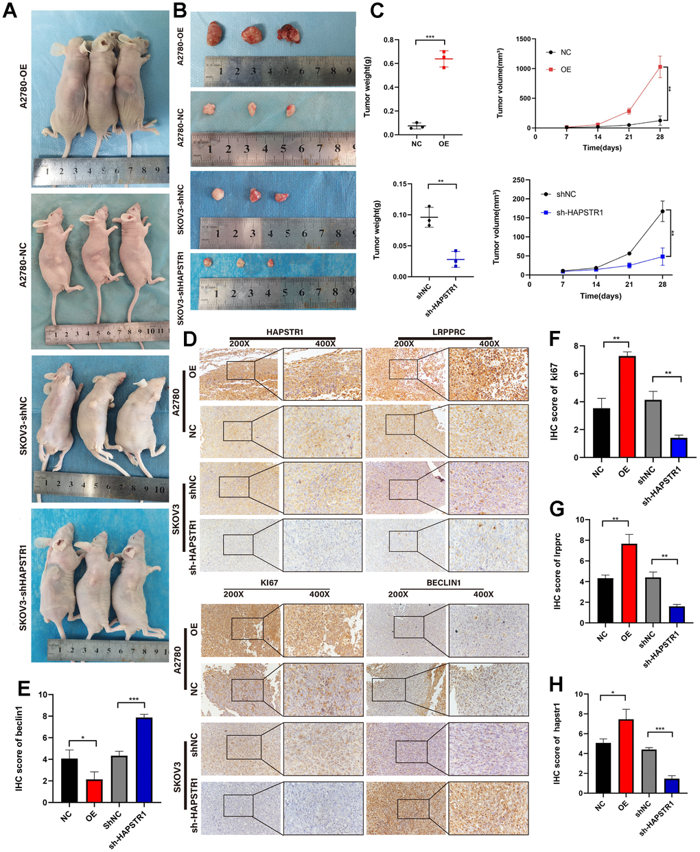 HAPSTR1 supports tumorigenicity in vivo and regulates the EMT pathway and autophagy markers. (A–C) Tumor weights and volumes in a subcutaneous xenografted nude mice model demonstrated that HAPSTR1 expression promotes ovarian cancer progression in vivo. (D–H) The immunohistochemistry assay suggested that the HAPSTR1 expression level influenced the expression levels of LRPPRC, KI67, and Beclin1 expression. Original magnification, 200x, 400x. *, p p p 