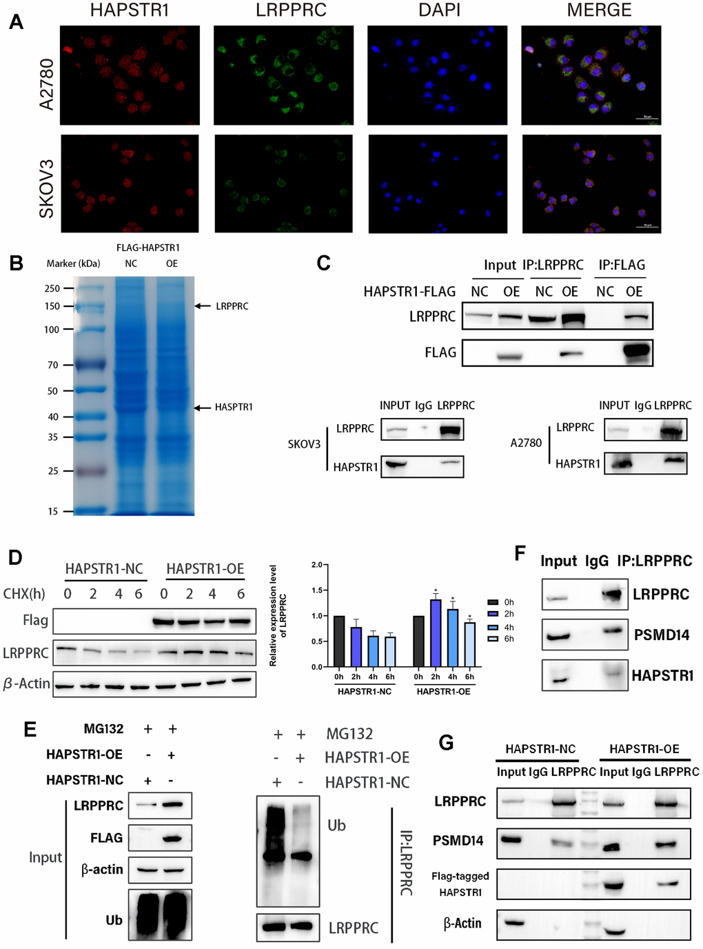 HAPSTR1 inhibits ubiquitination of LRPPRC and recruits PSMD14 to interact with LRPPRC. (A) Immunofluorescence staining was used to determine the common cellular localization of HAPSTR1 and LRPPRC. Original magnification: 400x. (B) The gels in the co-immunoprecipitation (COIP) assay were stained with Coomassie Brilliant Blue. (C) A COIP assay was used to detect the interaction between HAPSTR1 and LRPPRC in SKOV3 and A2780 cells. (D) HAPSTR promoted protein stability of LRPPRC under cycloheximide treatment. (E) HAPSTR1 suppressed ubiquitination of LRPPRC. (F) COIP was carried out to detect interactions between LRPPRC and HAPSTR1 and PSMD14 simultaneously. (G) HAPSTR1 recruited more PSMD14 for binding to LRPPRC.