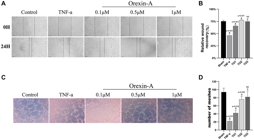 Orexin-A improved scratch wound healing and angiogenesis of TNF-α-injured HUVEC cells. (A) The image shows the effect of Orexin-A (TO1: 0.1 μM, TO2: 0.5 μM and TO3: 1 μM) on wound healing of TNF-α (10 ng/ml) injured cells. (B) Quantification of Orexin-A on wound closure (n = 3). (C) Representative images of the study effects of TNF-α (10 ng/ml) and the three concentrations (TO1: 0.1, TO2: 0.5 and TO3: 1 μM) of Orexin-A on tube formation. (D) Quantification of the effects of Orexin-A on the number of capillary-like tubes in TNF-α-treated cells (n = 3). Results are expressed as means ± standard deviation, the statistical significance of differences was evaluated by One-way ANOVA, *denotes the comparison between the Sham group and the TBI group, #represents the comparison between the TBI and the Sham-tDCS group, &signifies the comparison between the tDCS group and the Sham-tDCS group, and ¥indicates the comparison between the tDCS group and the tDCS+SB334867 group. P 