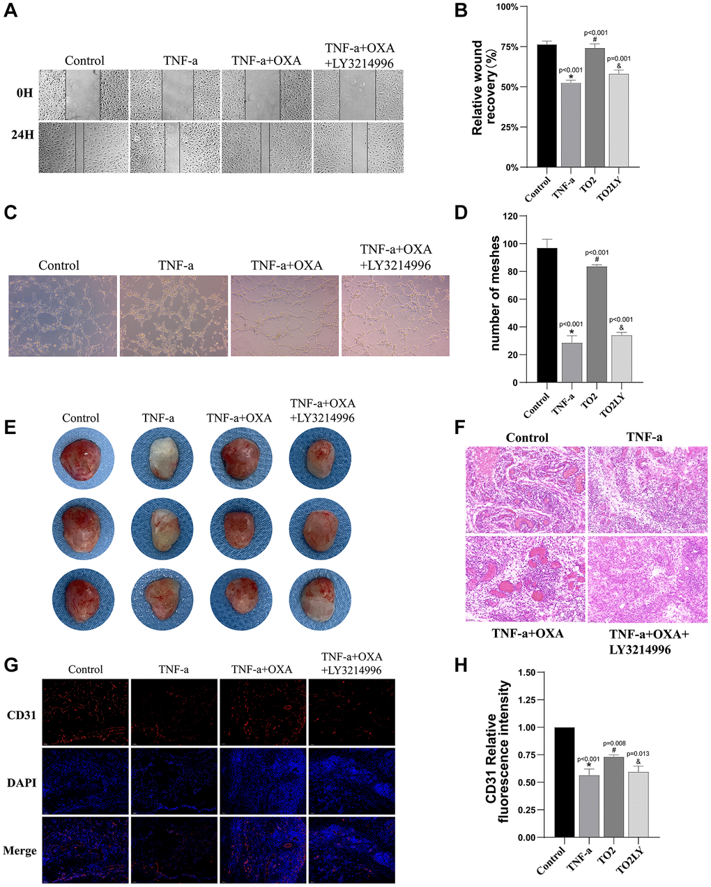 Orexin-A enhanced HUVEC angiogenesis and wound healing through TF-AKT/ERK pathway. (A) Representative images depicting the combined administration of LY3214996 (1 μM) and Orexin-A (0.5 μM) on wound healing effects. (B) The quantification of scratch assay results for each group is shown, measuring the closure of scratch gaps (n = 3). (C) Representative images illustrating the impact of the combined administration of LY3214996 (1 μM) and Orexin-A (0.5 μM) on vascular formation. (D) Displays the quantification of tube formation assay results for each group, calculating the number of formed tubes (n = 3). (E) Representative gross morphology of Matrigel in situ (n = 3). (F) Representative H&E-stained images of matrix plug sections (n =3). (G) Representative immunofluorescence images of CD31-positive cells within matrix plugs. (H) Quantitative analysis of the proportion of CD31-positive cells within matrix plugs (n = 3). Results are expressed as means ± standard deviation, the statistical significance of differences was evaluated by One-way ANOVA, *denotes the comparison between the Sham group and the TBI group, #represents the comparison between the TBI and the Sham-tDCS group, &signifies the comparison between the tDCS group and the Sham-tDCS group, and ¥indicates the comparison between the tDCS group and the tDCS+SB334867 group. P 