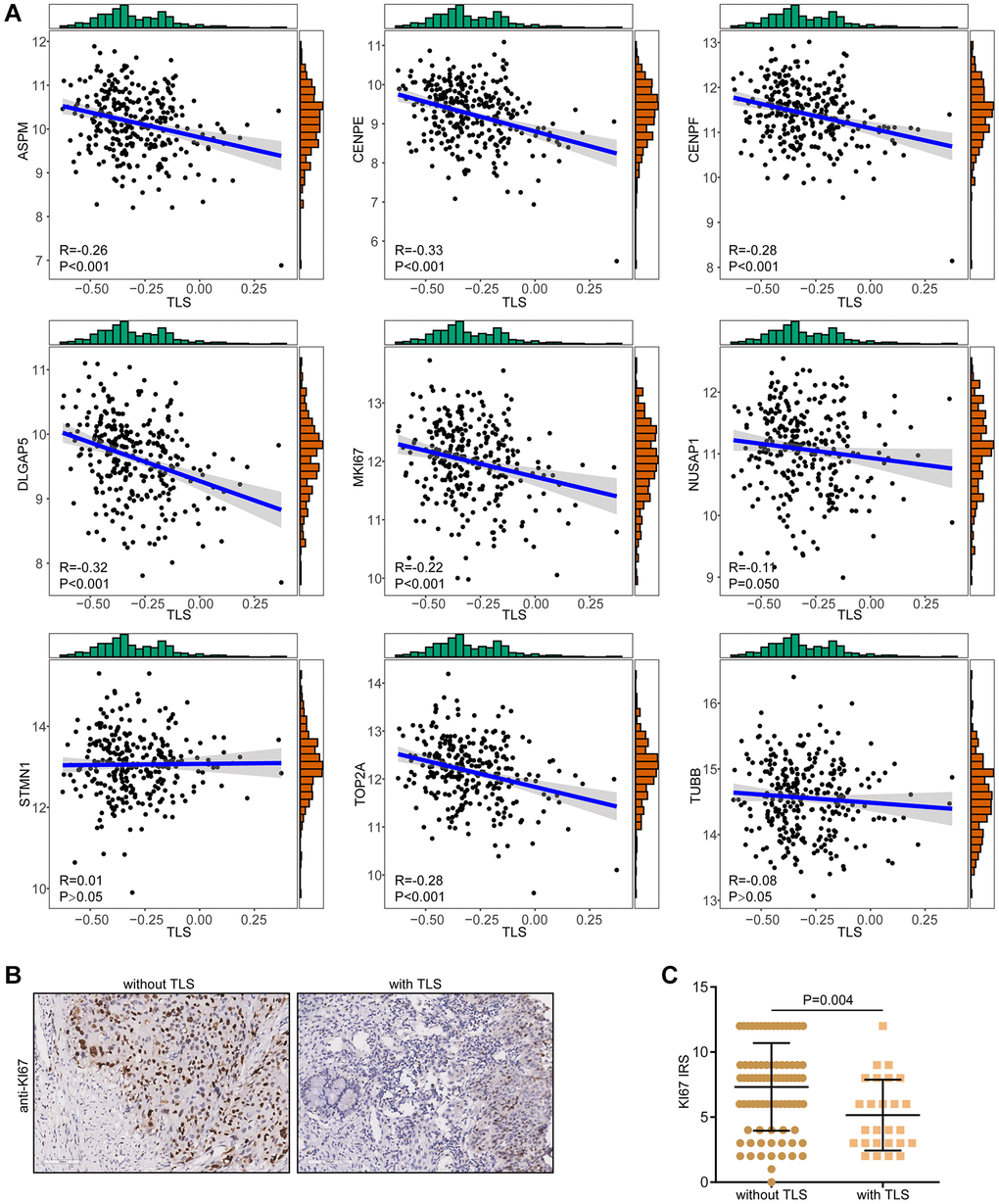 Correlations between TLS and proliferation biomarkers. (A) Correlations between TLS score and a total of nine proliferation biomarkers in the TCGA-CESC cohort. (B, C) Representative images revealing KI67 expression in CESC samples with or without TLS and semi-quantitative analysis.