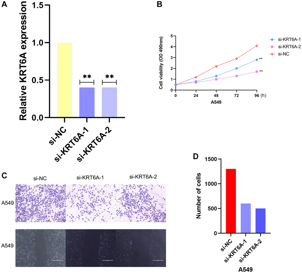 Effects of KRT6A knockdown on NSCLC cell viability and migratory capacity in vitro. (A) KRT6A expression in A549 cell transfected with negative control siRNA (si-NC) or siRNAs targeting KRT6A (si-KRT6A #1 and #2) for 48 h, n = 3 for each group. (B) Cell viability was assessed using a CCK-8 assay in A549 cell transfected with si-NC or si-KRT6A #1 and #2 for 48 h, n = 6 for each group. (C, D) Transwell invasion assay was performed to determine the invasion ability of si-KRT6A-transfected A549 cell for 48 h, n = 3 for each group. *P **P ***P 