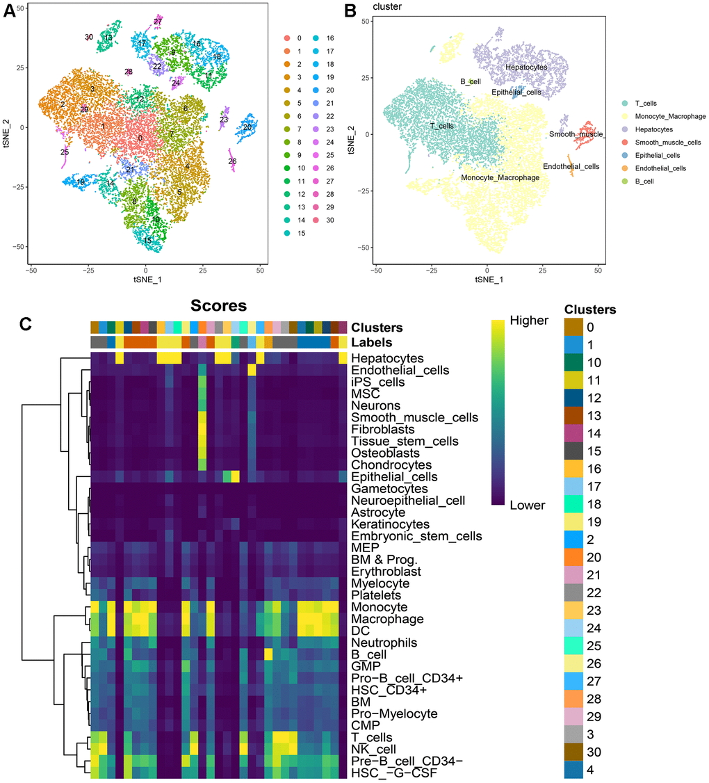 Single-cell atlas of 2 HCC patients. (A) t-SNE dimensionality reduction subtypes; (B) t-SNE dimensionality reduction cell annotations; (C) singleR automated annotation results.