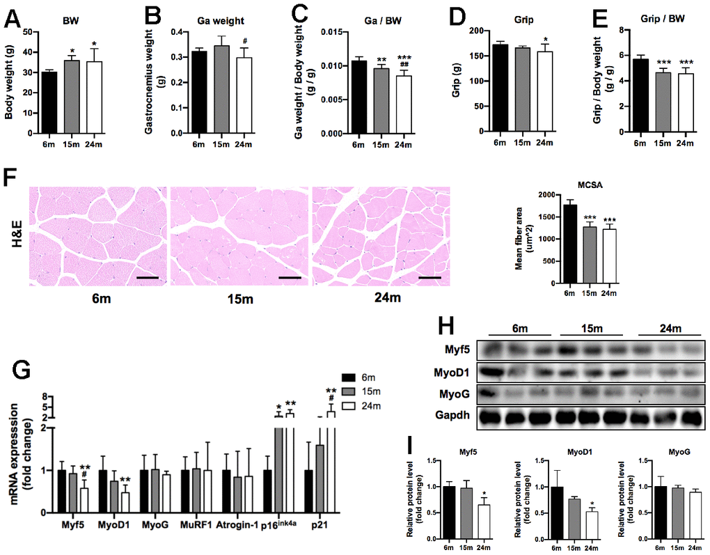 Changes in body weight (BW), gastrocnemius muscle weight (Ga weight), four-limb grip strength (Grip), MCSA, and expression of myogenesis and senescence-related makers during aging. (A) Body weight of mice; (B) Ga weight of mice; (C) Ga weight normalized by BW (Ga weight/BW); (D) Grip strength of mice; (E) Grip strength normalized by BW (Grip/BW), n=10 for 6m group, n=9 for 15m group, n=11 for 24m group (A–E); (F) Representative H&E staining images of Ga muscle section and quantitative analysis of MCSA level of three groups, Scale bar: 50 μm, n=3; (G) mRNA levels of myogenesis and senescence-related makers, n=7; (H) Representative Western blots and (I) quantification of Myf5, MyoD1, MyoG and Gapdh (loading control), n=3. *p
