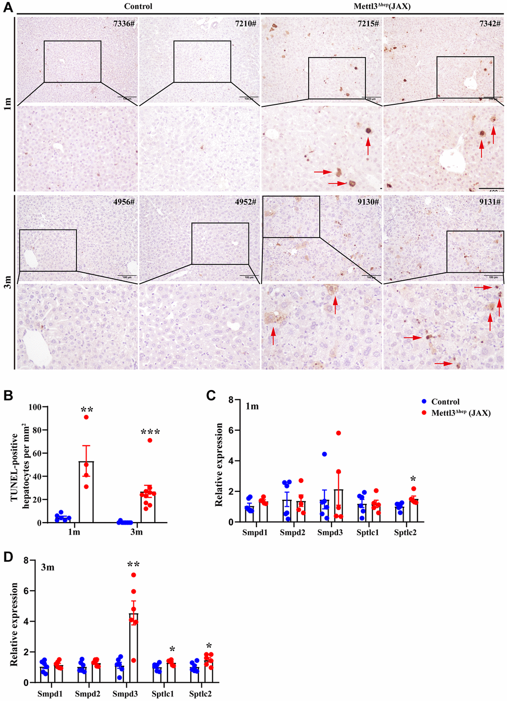 Hepatocyte-specific METTL3 homozygous ablation by Alb-Cre mice (JAX) results in apoptosis in mouse hepatocytes. (A) Representative TUNEL staining images of paraffin-embedded liver sections from control mice and METTL3Δhep mice (JAX) at 1 month or 3 months after birth. Scale bar = 100 μm. (B) Quantification of TUNEL-positive hepatocytes in paraffin-embedded liver sections from control mice and METTL3Δhep mice (JAX). (C, D) qRT-PCR analysis of the expression of genes related with sphingolipid metabolism in the liver of METTL3Δhep mice (JAX).