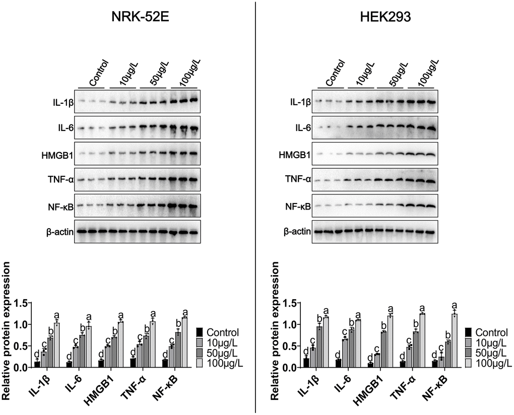 Effects of MCCPs on inflammation in NRK-52E and HEK293 cells. Western blot analysis of the effects of MCCPs on the expression of inflammatory factors. p 