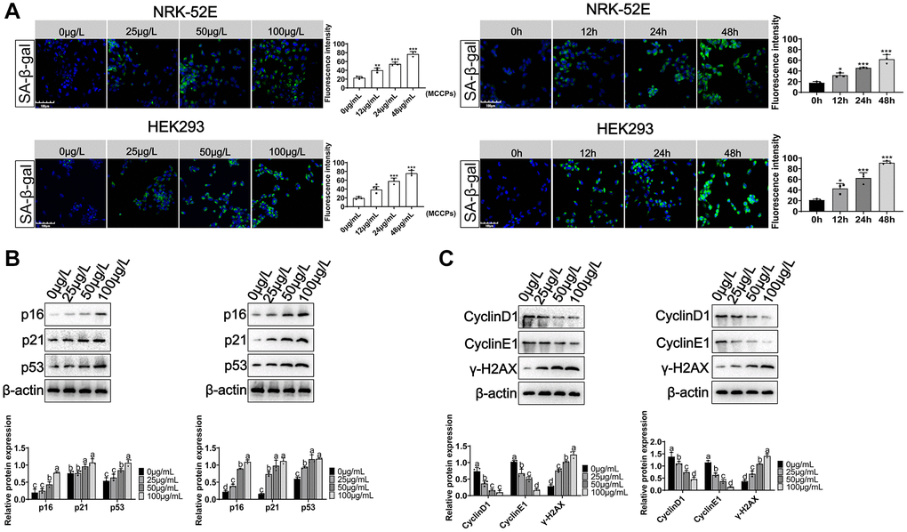 Effects of MCCPs on renal cell senescence. (A) Sa-β-gal staining of NRK-52E and HEK293 cells after MCCPs treatment. (B) Effects of MCCPs on p16/p21/p53 expression in NRK-52E and HEK293 cell model. (C) Effect of MCCPs on the expression of CyclinD1, CyclinE1 and γ-H2AX. p 
