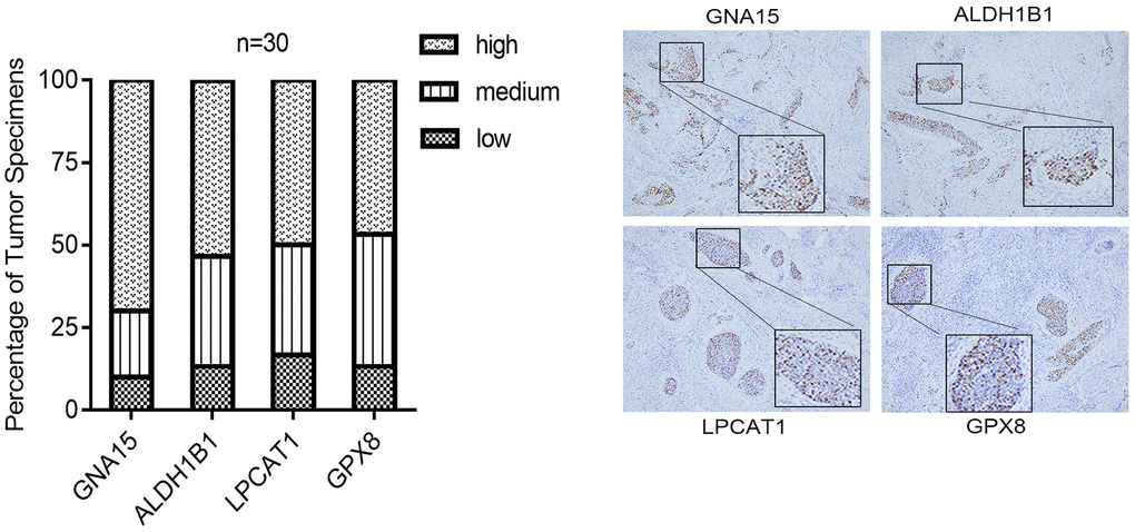 The IHC staining validation results of the hub genes, including GNA15, ALDH1B1, LPCAT1, and GPX8, in CESC tissues.